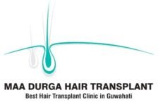durgahairtransplant.in